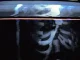 BONES – CARCASS